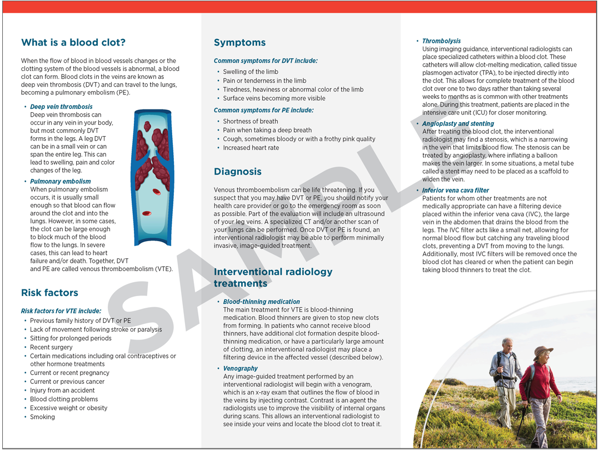 DeepVeinThrombosisandPulmonaryEmbolism2.png